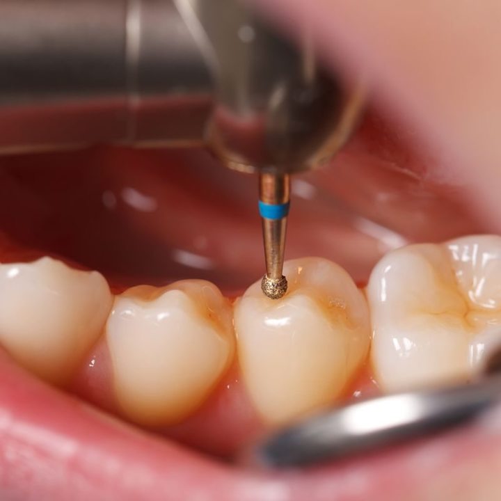 Gables Dental Care Image