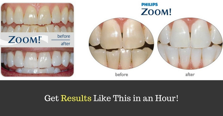 Apple Springs Family Dentistry Image