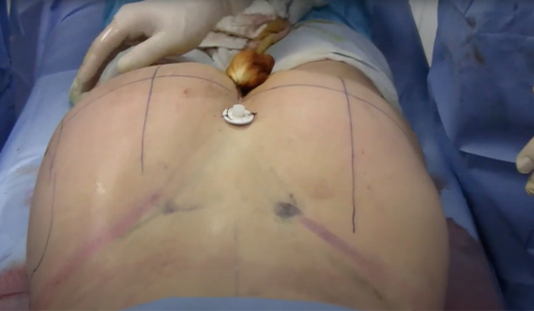 Bellevue Plastic Surgeons, PLLC Image