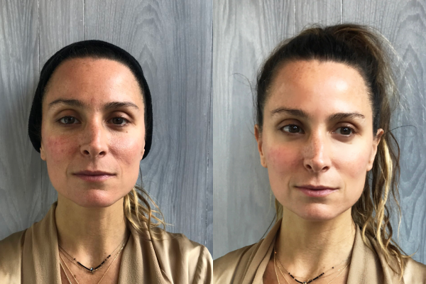 Texas Laser Therapy, LLC