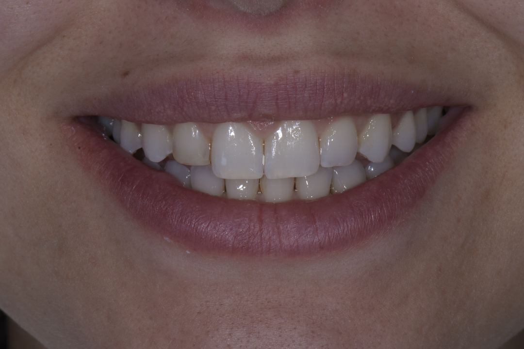 Luminous Smiles Image