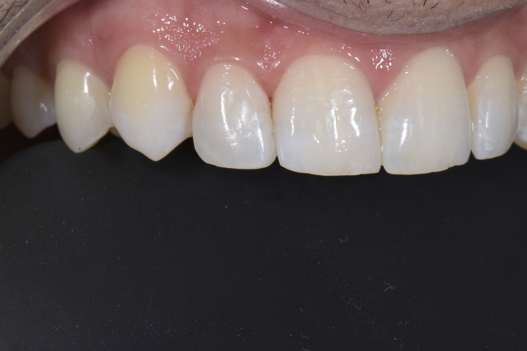 Luminous Smiles Image