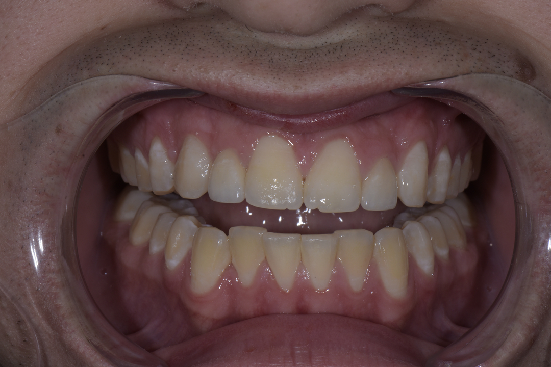 Luminous Smiles Image