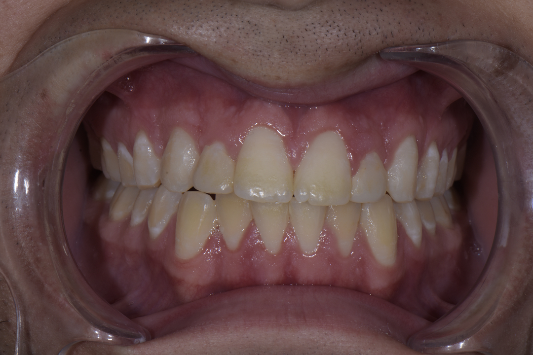 Luminous Smiles Image