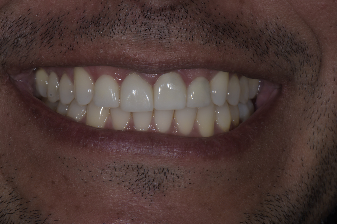 Luminous Smiles Image