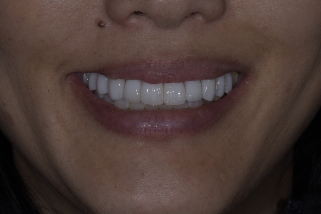 Luminous Smiles Image