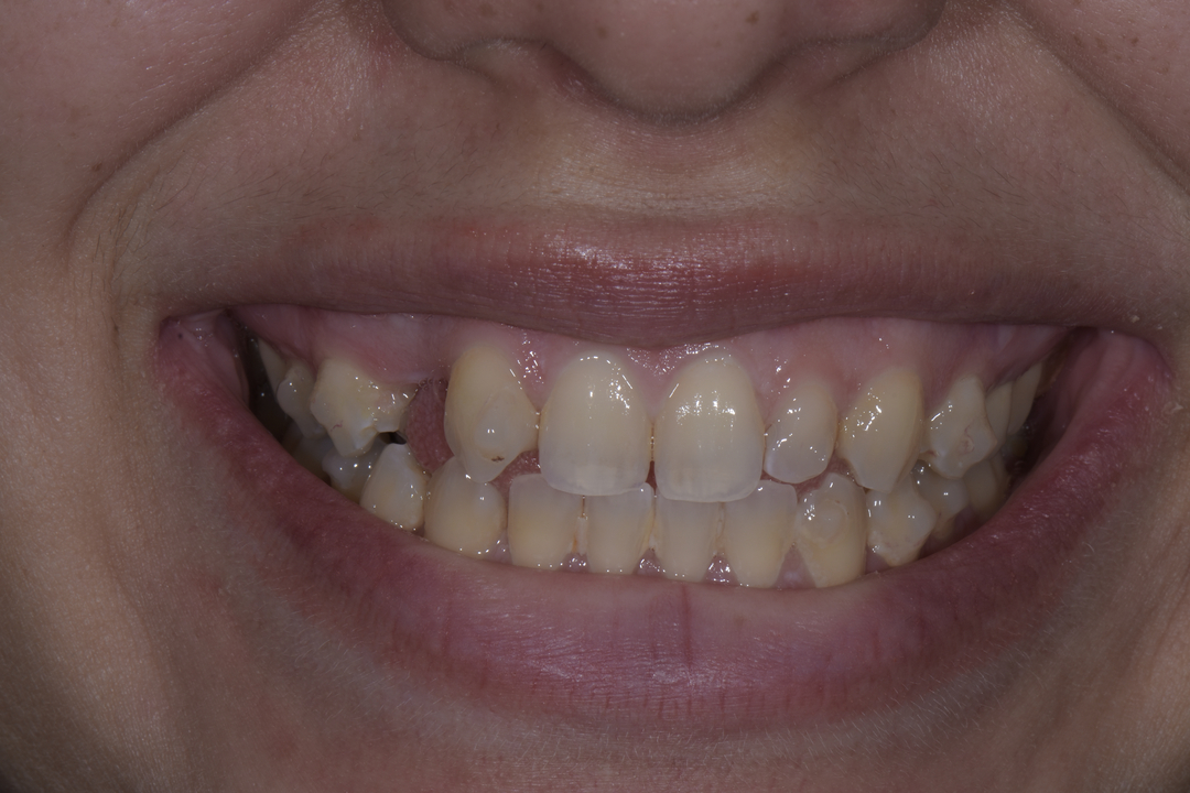 Luminous Smiles Image