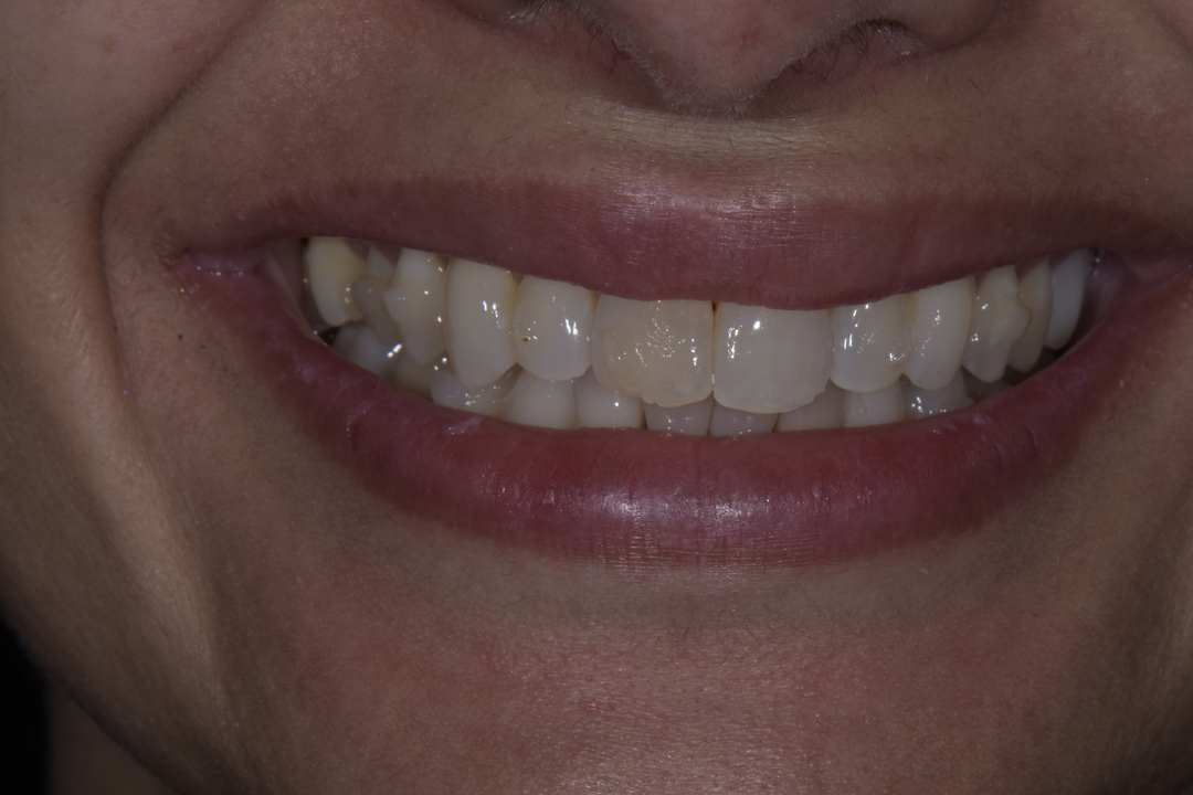 Luminous Smiles Image