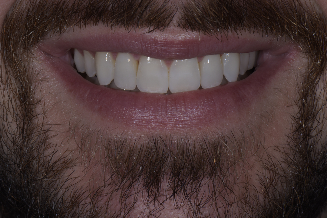 Luminous Smiles Image