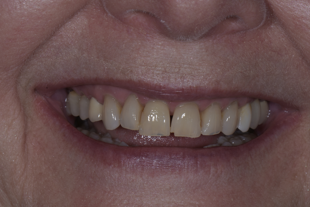 Luminous Smiles Image