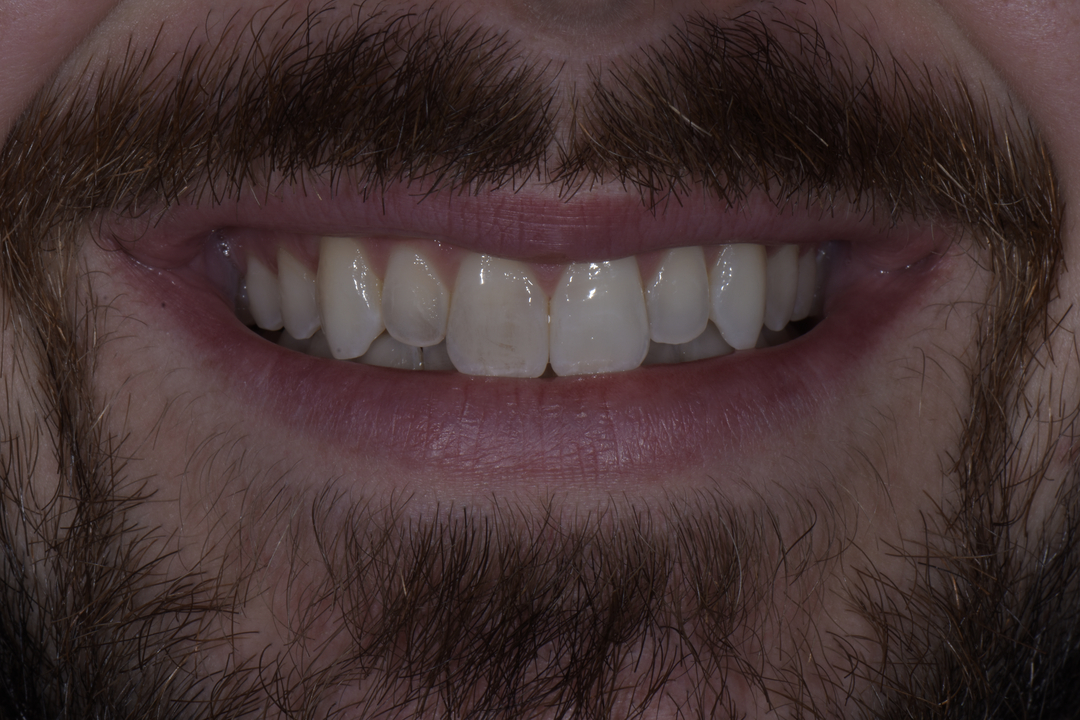 Luminous Smiles Image