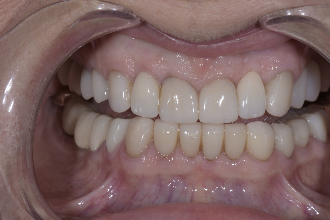 Luminous Smiles Image