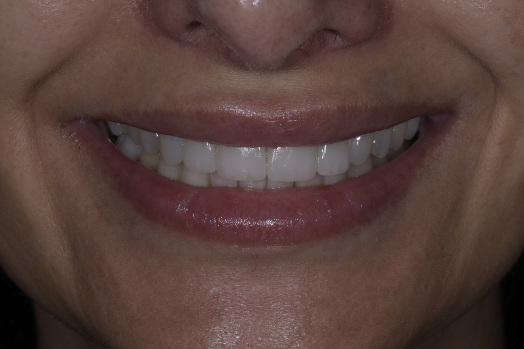 Luminous Smiles Image