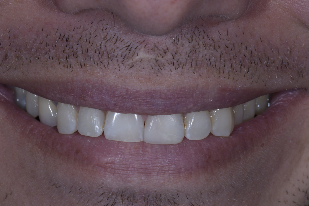 Luminous Smiles Image