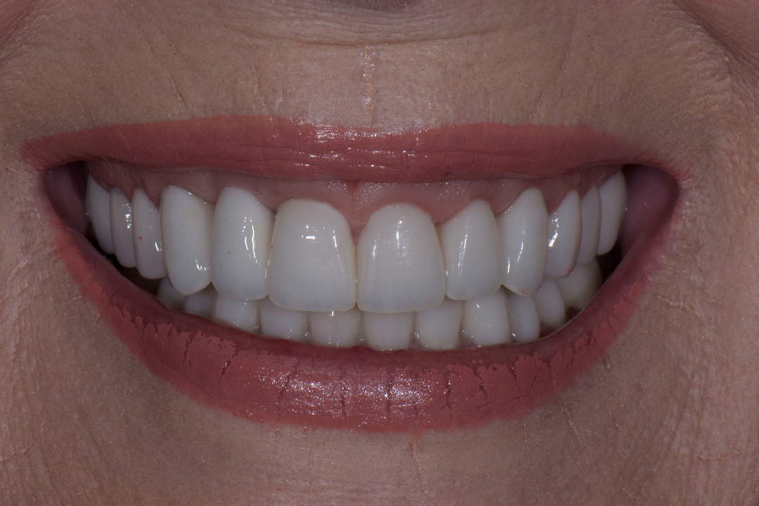 Luminous Smiles Image