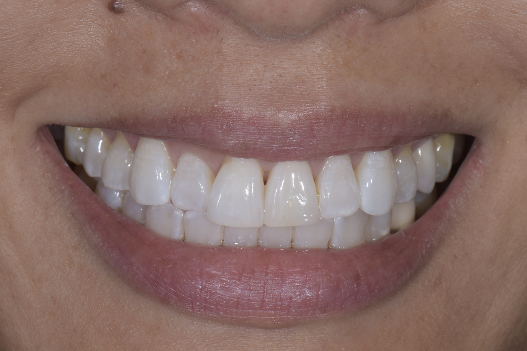 Luminous Smiles Image