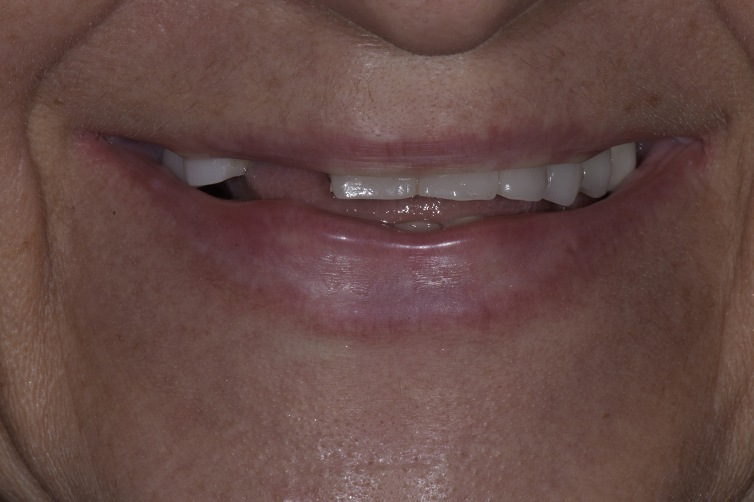 Luminous Smiles Image