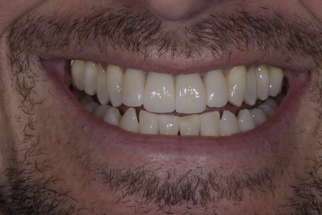 Luminous Smiles Image