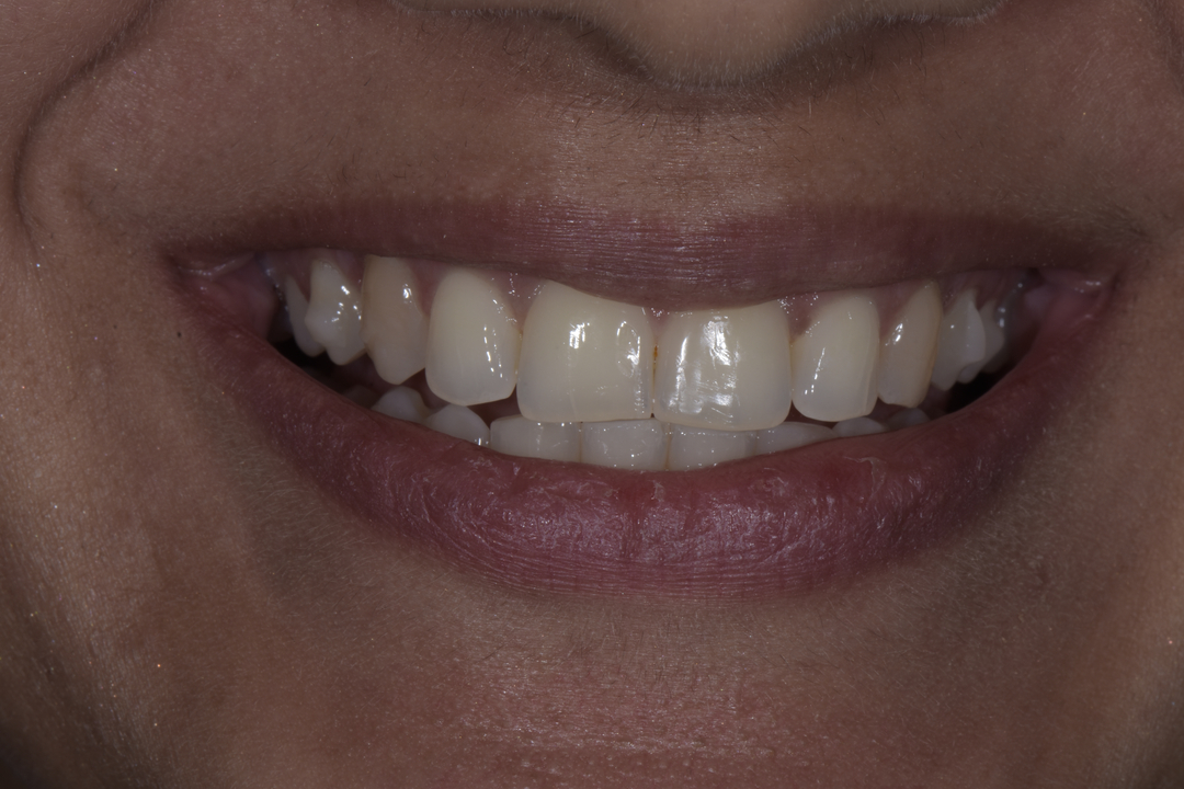 Luminous Smiles Image