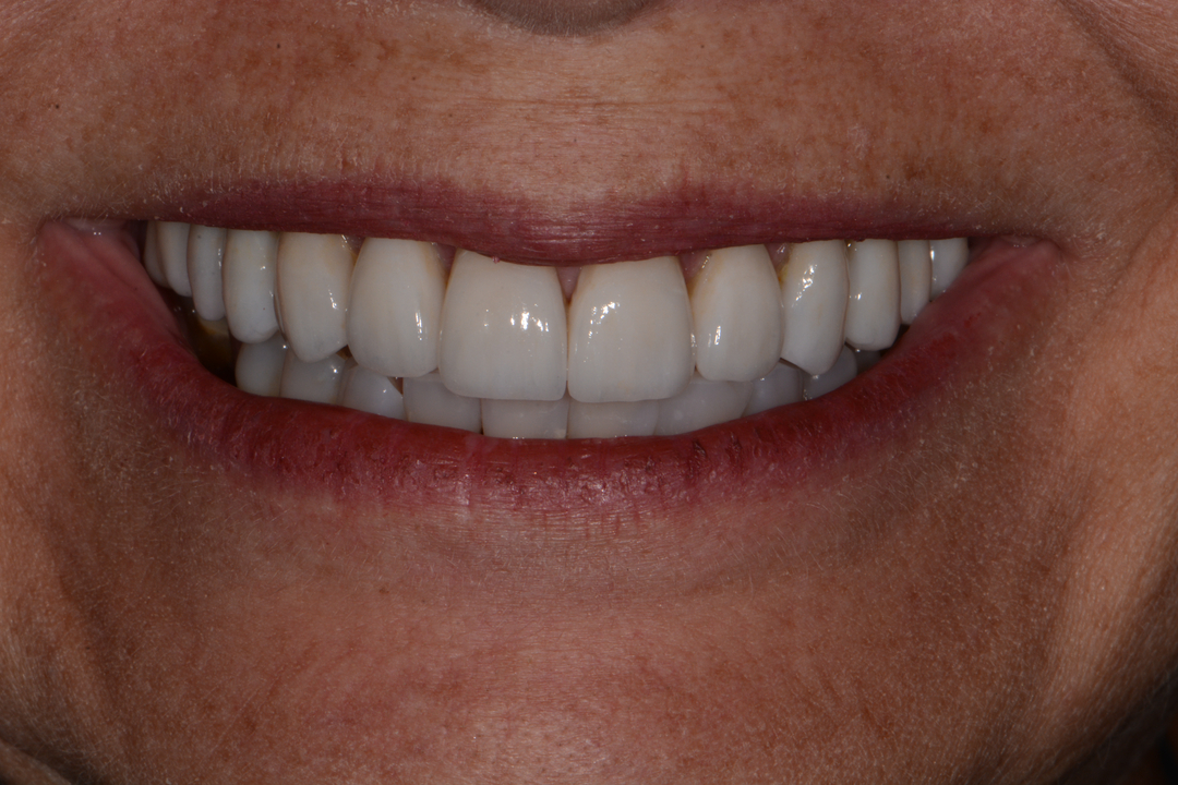 Luminous Smiles Image