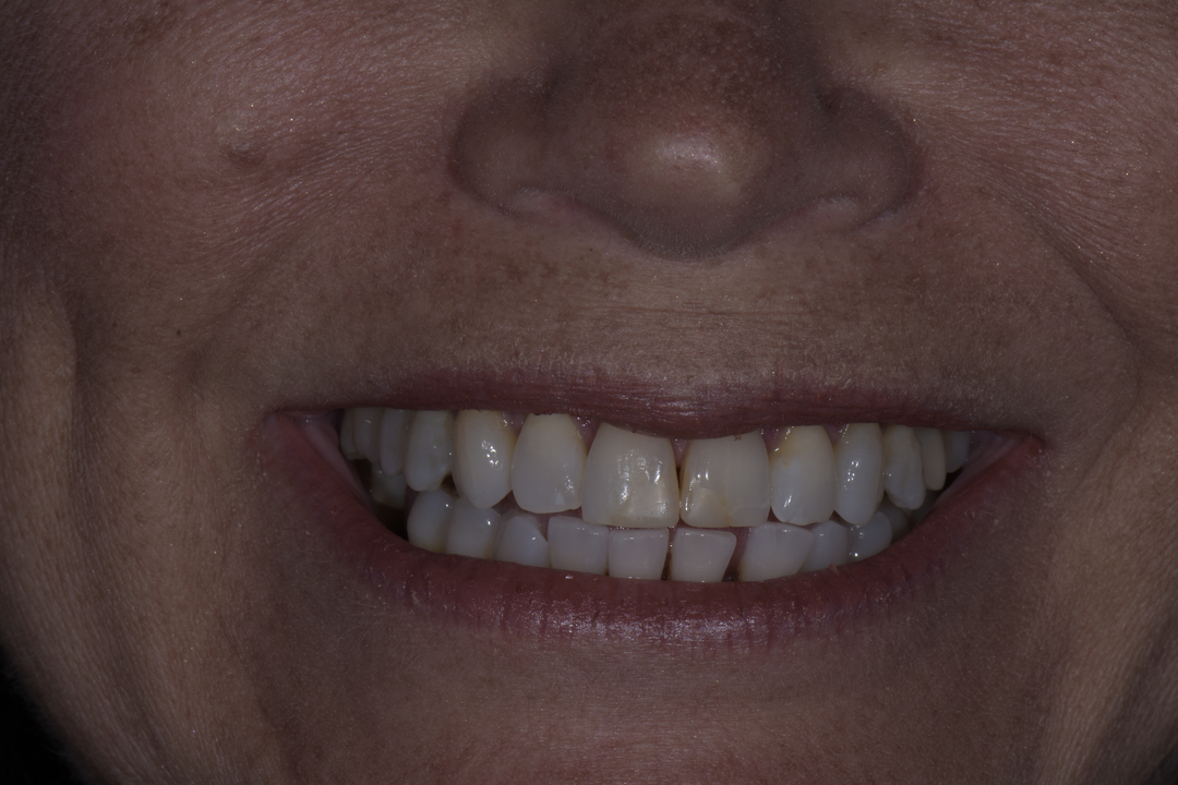 Luminous Smiles Image