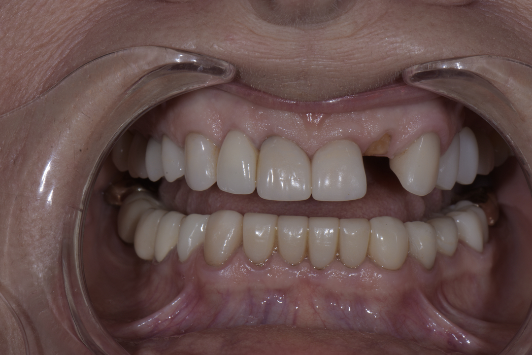 Luminous Smiles Image