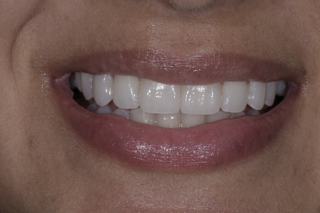 Luminous Smiles Image