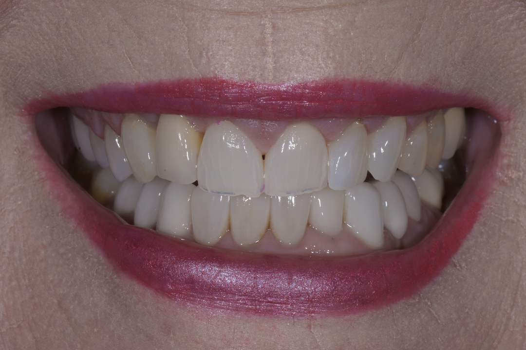 Luminous Smiles Image