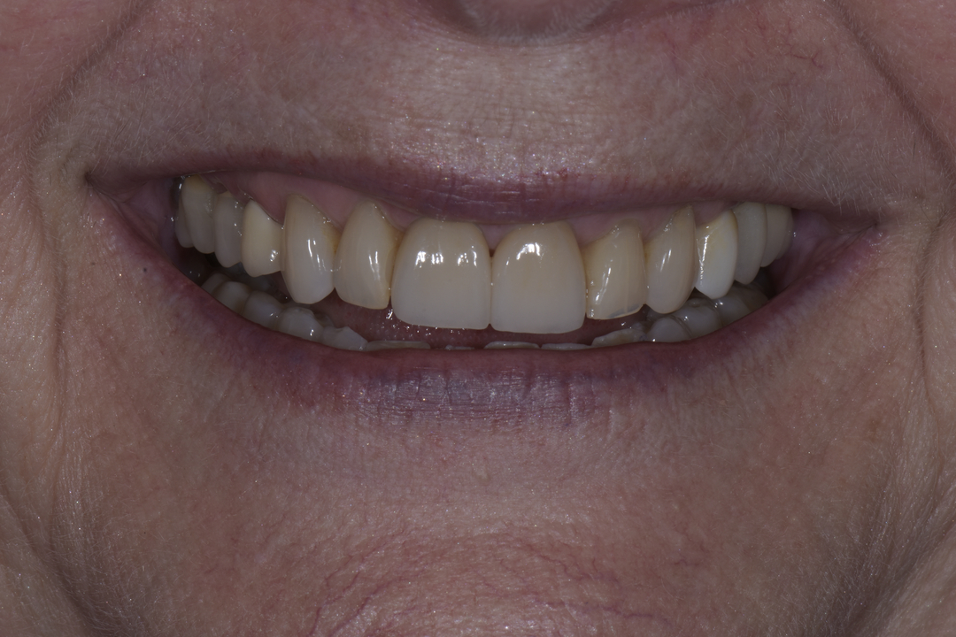 Luminous Smiles Image