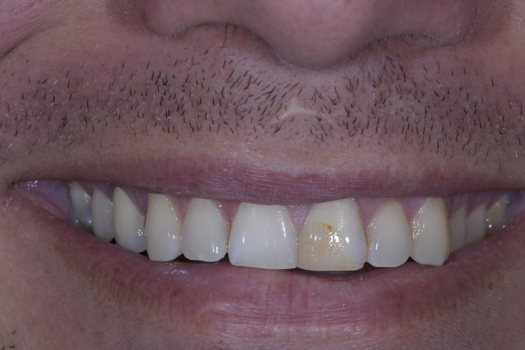 Luminous Smiles Image