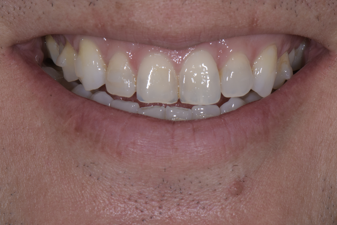 Luminous Smiles Image