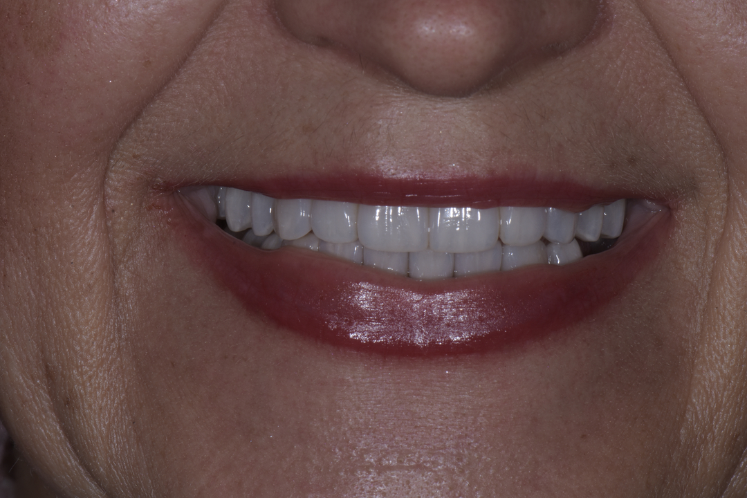 Luminous Smiles Image