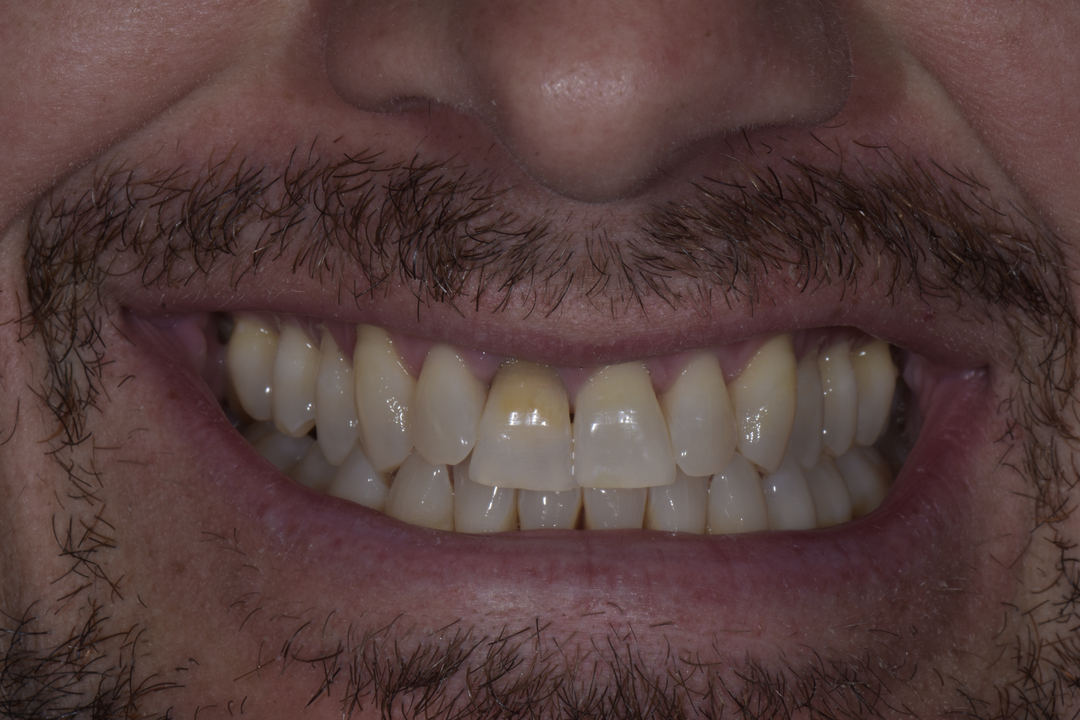 Luminous Smiles Image