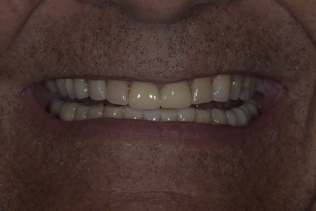 Luminous Smiles Image