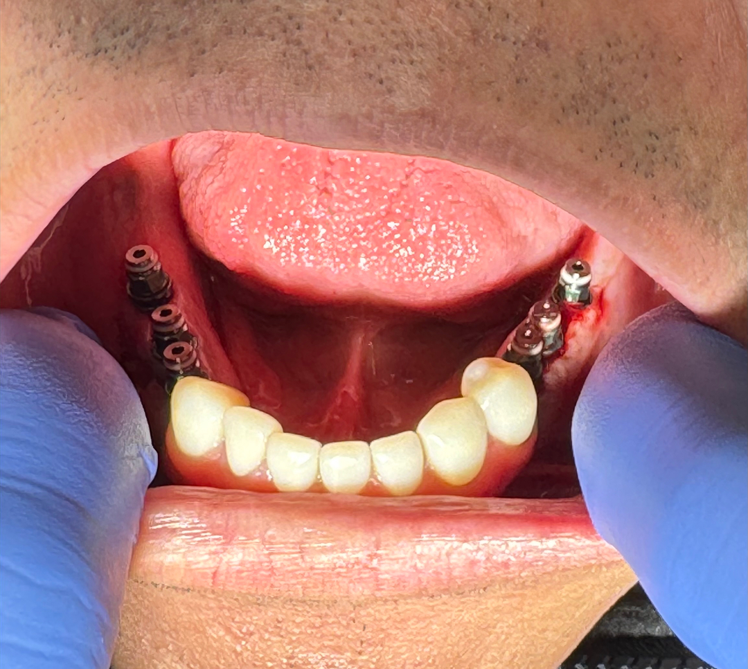 Dentistry of Bellevue WA Image