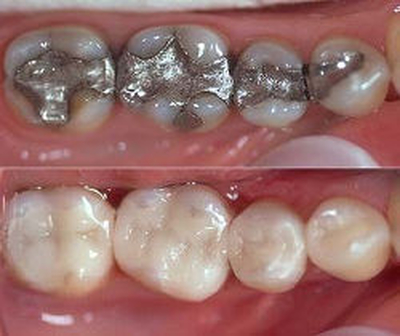 Dentistry of Bellevue WA Image