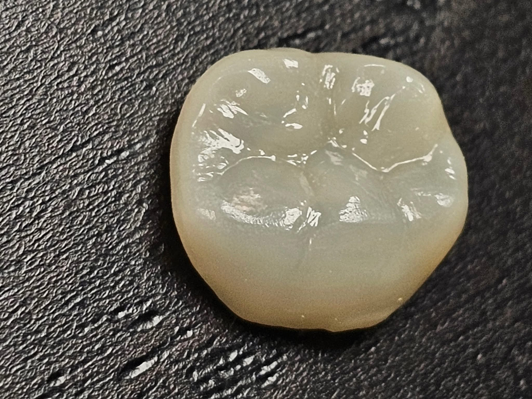 Dentistry of Bellevue WA Image