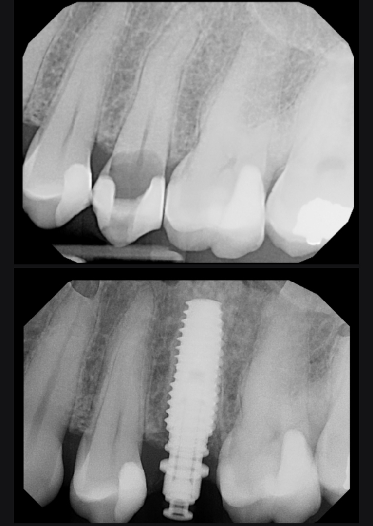 Dentistry of Bellevue WA Image