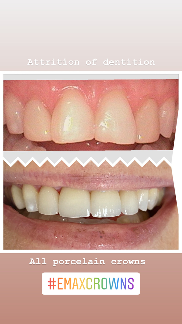 Dentistry of Bellevue WA Image