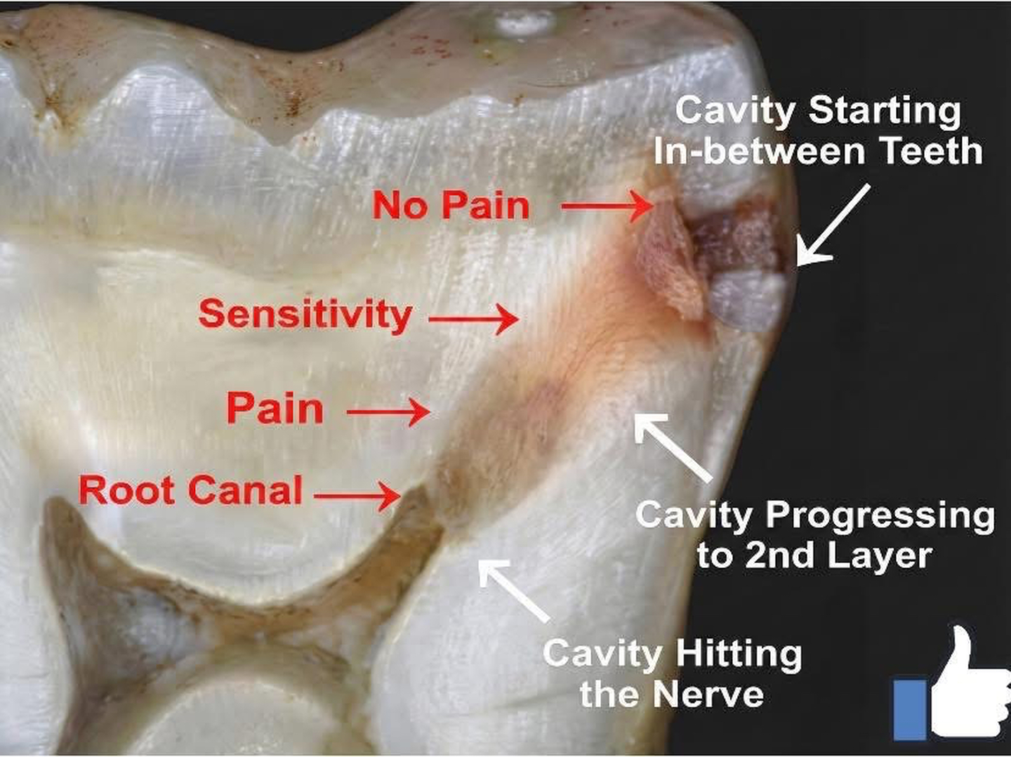 Dentistry of Bellevue WA Image