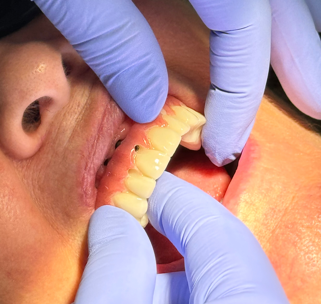 Dentistry of Bellevue WA Image