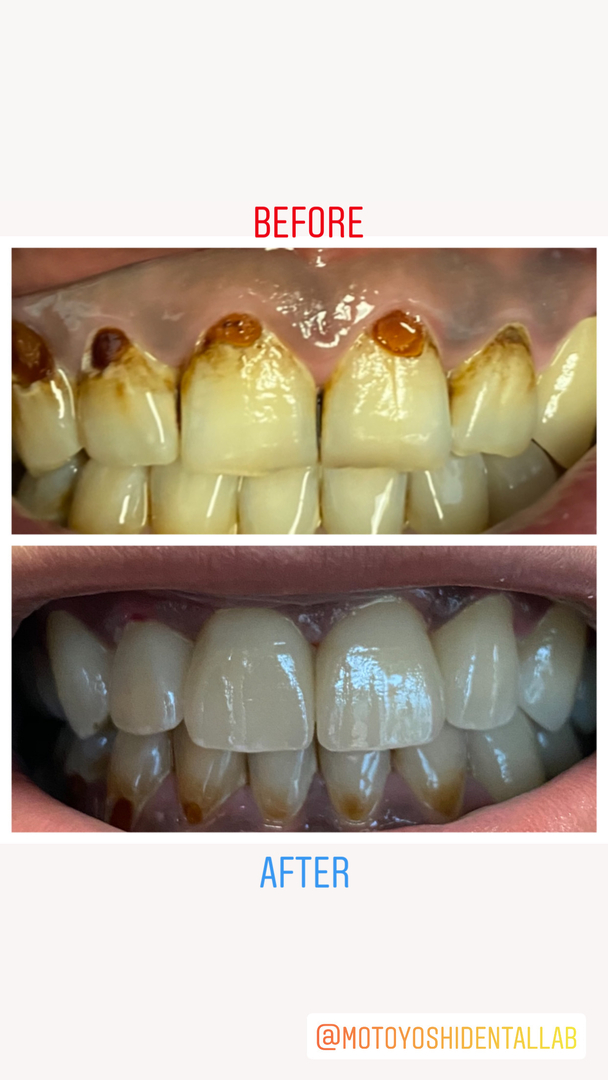 Dentistry of Bellevue WA Image