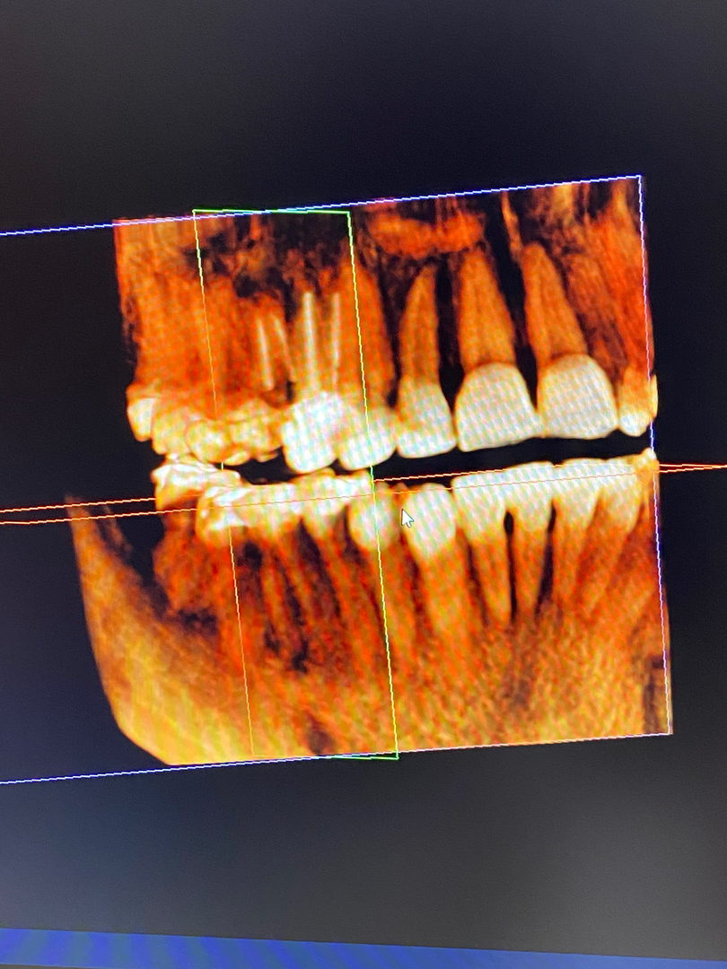 Dentistry of Bellevue WA Image