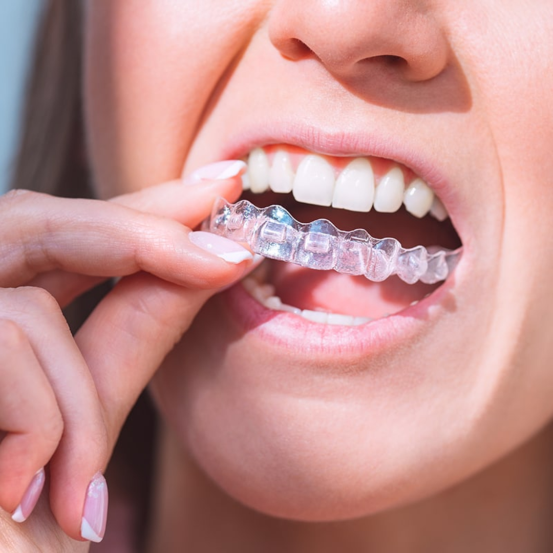 Smile High Dental Care Image