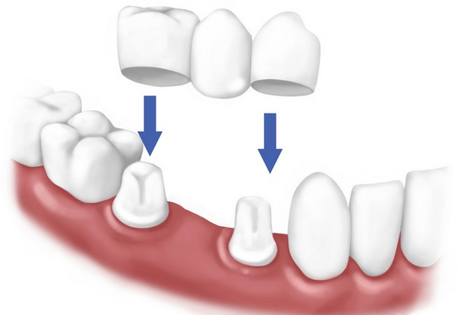 Smile High Dental Care Image