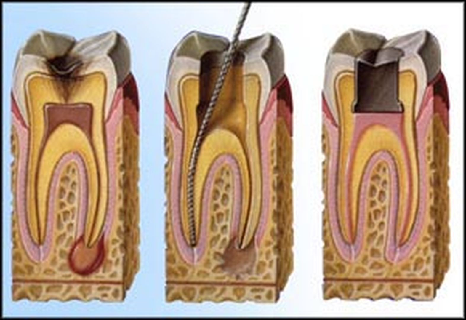Smile High Dental Care Image