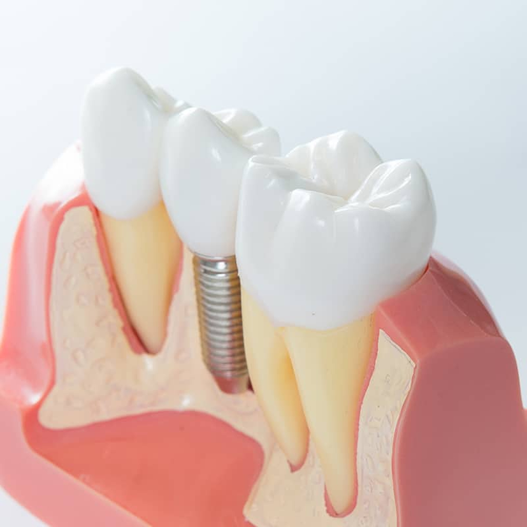 Smile High Dental Care Image