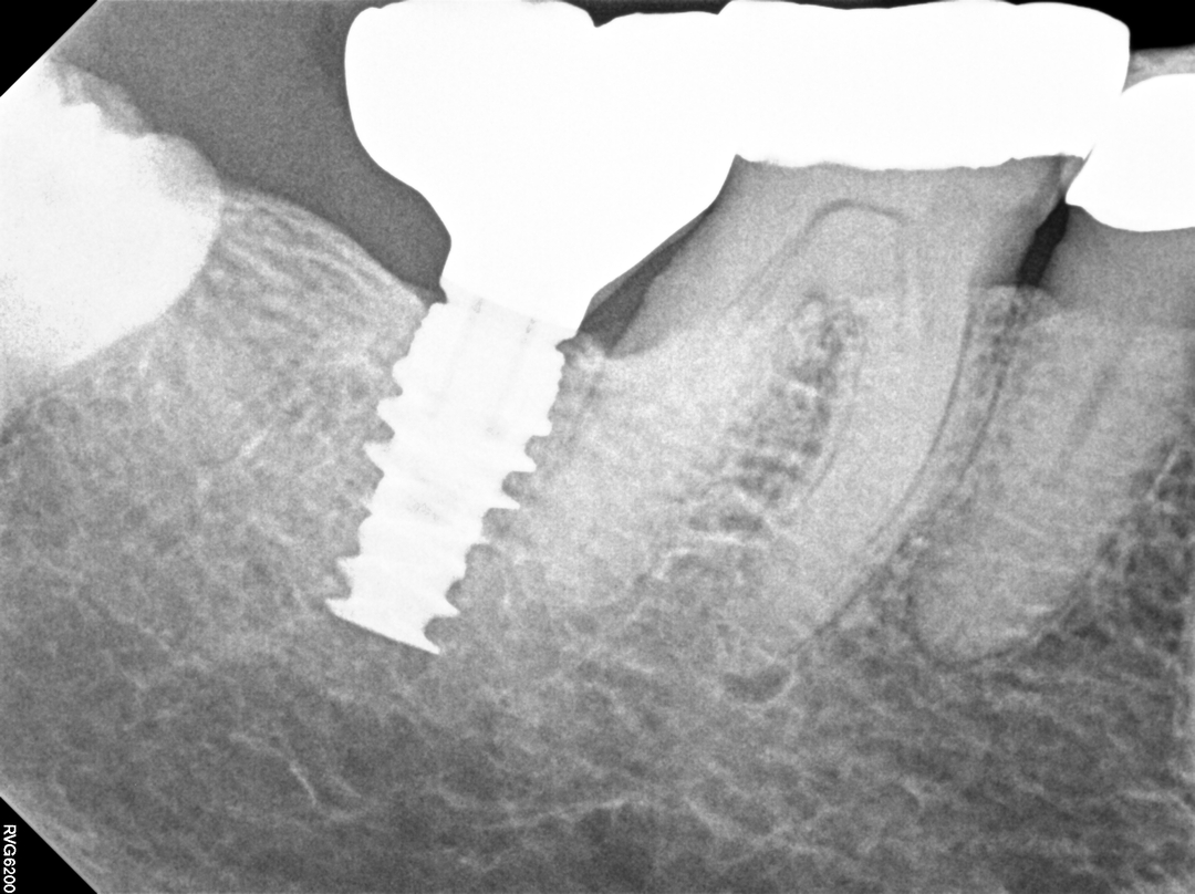 Smile High Dental Care Image