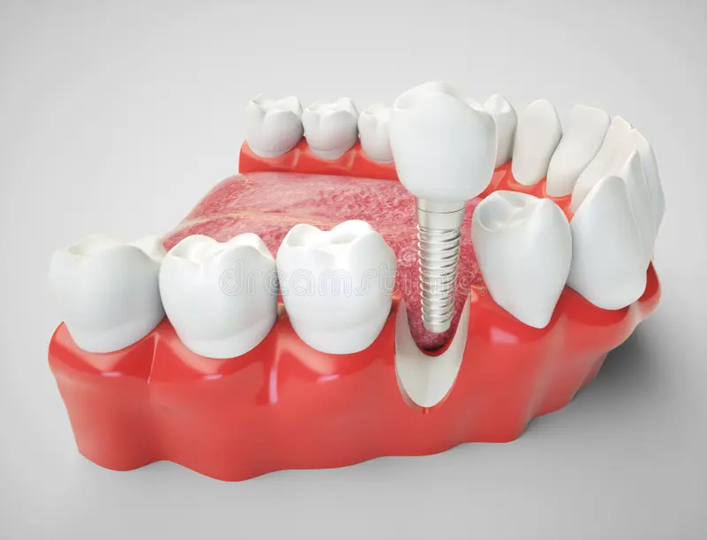 Smile High Dental Care Image