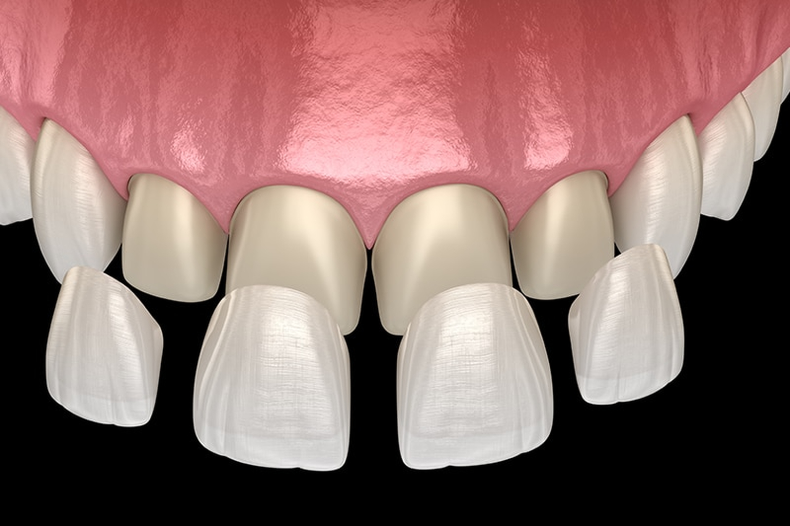 Smile High Dental Care Image